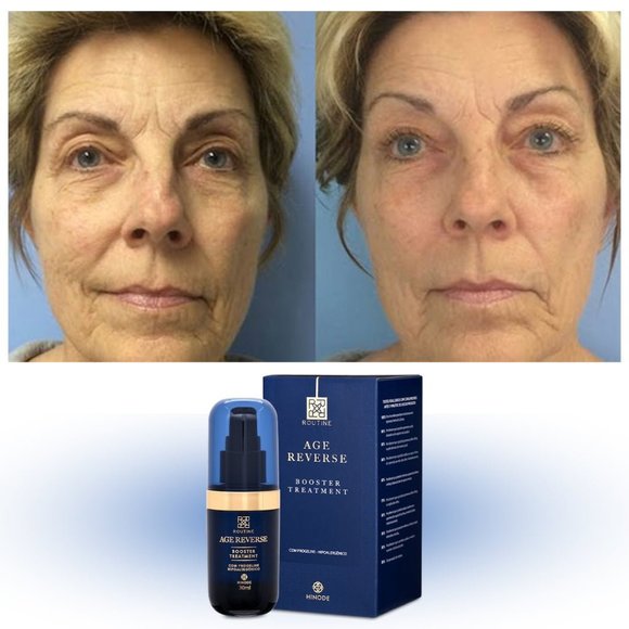 AGE REVERSE BOOSTER TREATMENT - Picture 1 of 1